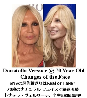 ドナテラ・ヴェルサーチ